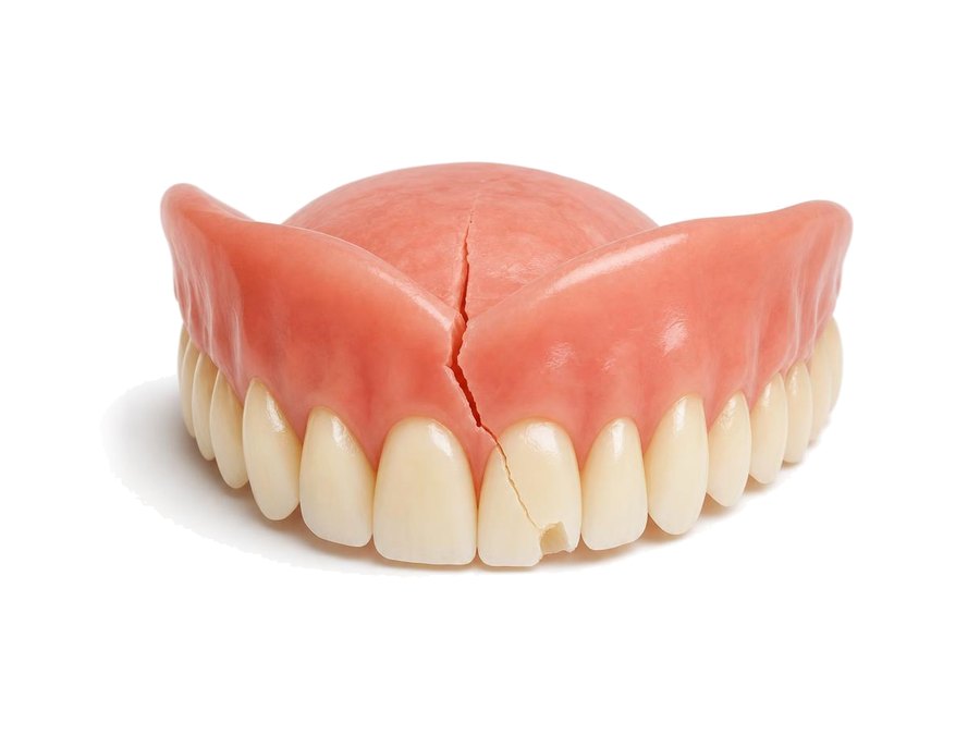An upper denture with a crack running through the gum and a chipped front tooth.